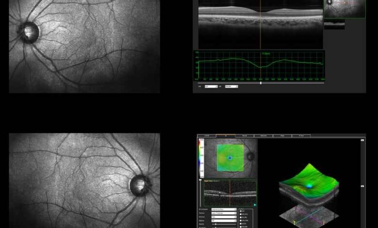 odac eye test meaning