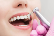teeth cleaning near me