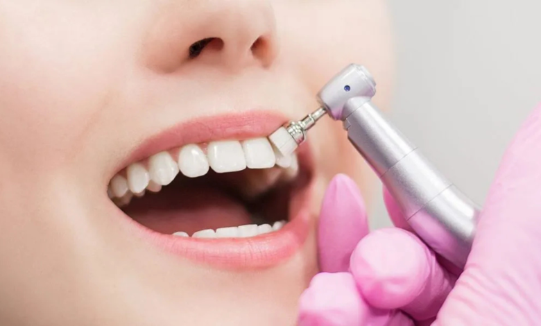 teeth cleaning near me