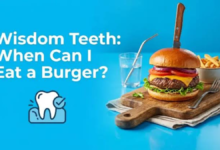 how long after wisdom teeth removal can i eat a burger