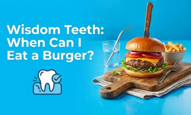 how long after wisdom teeth removal can i eat a burger
